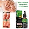 Nail Care Lotion Fine Texture Treat Fungal Infection Reliable Great Broken Cracked Discolored Nails Repair Liquid Supplies