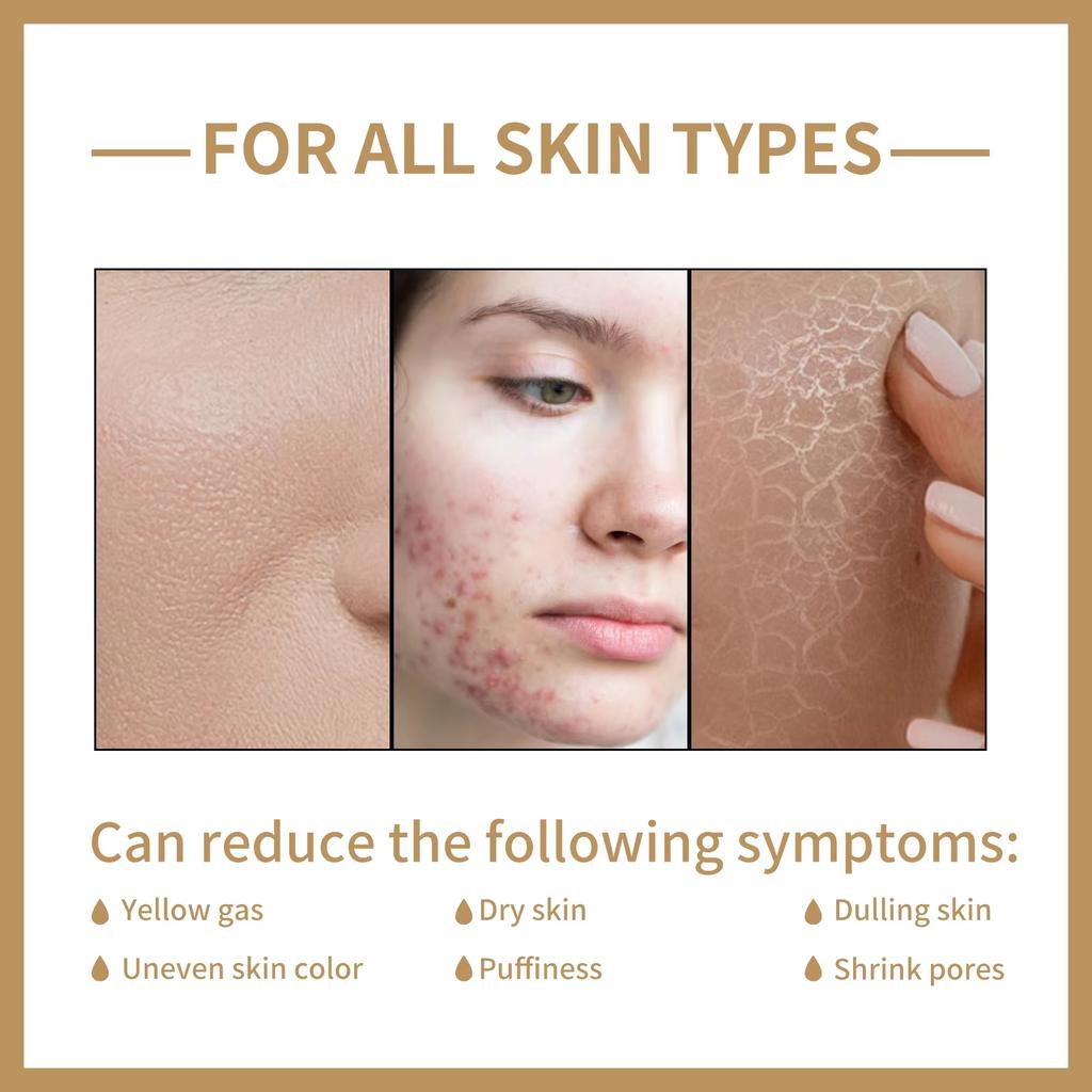 EELHOE Тонер на рисовой основе Увлажняющая вода Контроль жирности Разглаживание морщин на лице Сужение пор Восстановление Уход за кожей Тоник на рисовой воде 150 мл