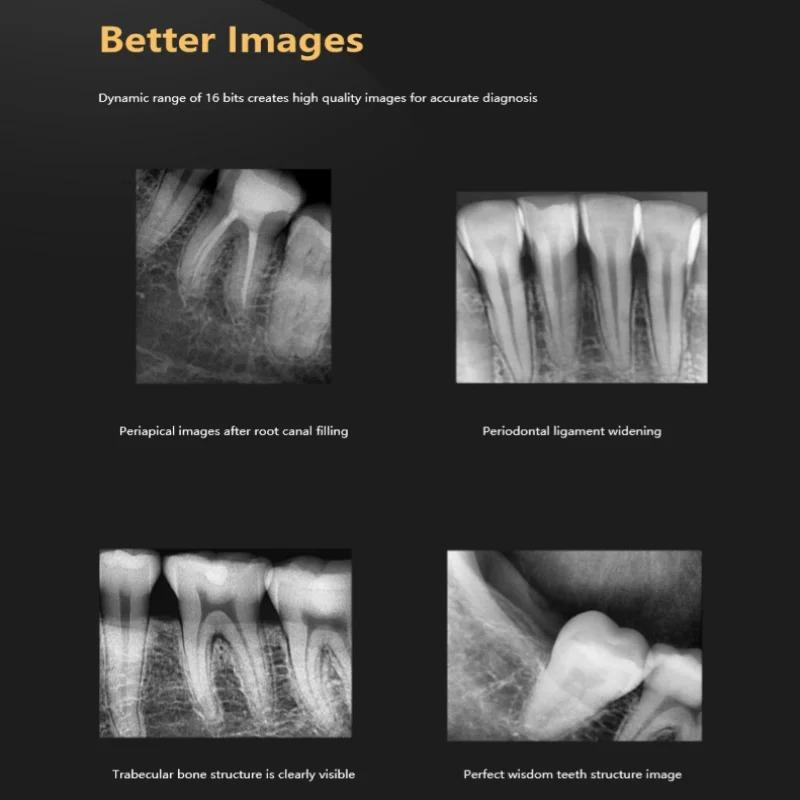 Стоматологический рентгеновский датчик Радиовизограф HD Цифровая интраоральная система визуализации Портативный рентгеновский цифровой датчик Стоматологические инструменты Инструменты