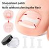I-shaped Inlaid Nail Positive Nail Sticker Physical Stretching Patch Pull Nail Groove Curl Nail Small Invisible Shoes Can Walk