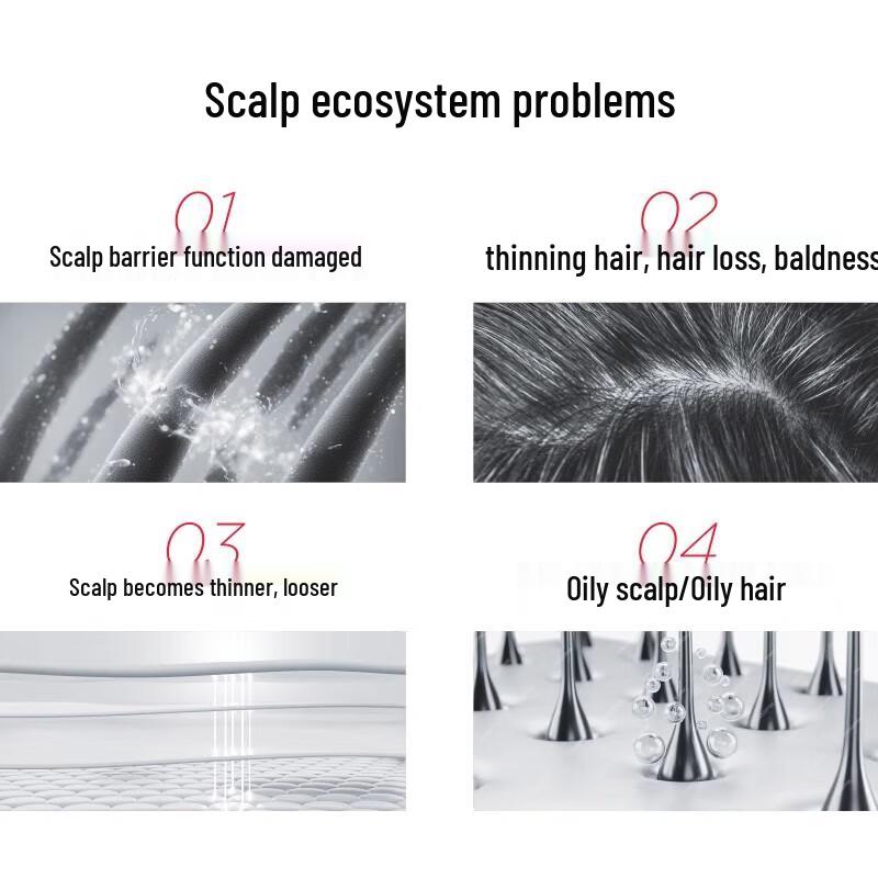 Sunsilk PRO Amino Acid Anti-Hair Loss Shampoo