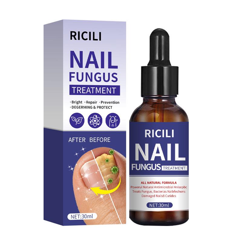 Guo Yi Onychomycosis Patch: Nail & Toe Care for Gray Nails