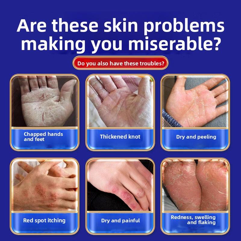 Полностью натуральный крем от дерматита - Успокаивает зудящую кожу, Мягкий для чувствительных типов, Облегчает экзему