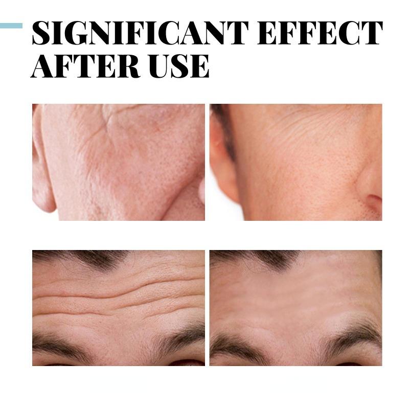 Мужской антивозрастной крем Увлажняющий, увлажняющий, морщины на лице, опреснение, тонкие линии, увлажняющий, укрепляющий крем для кожи