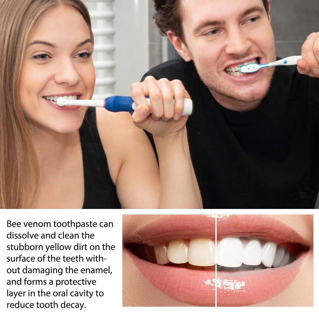 Отбеливающая зубная паста, уход за деснами, чистые пятна, желтые зубы, зубной камень, удаление запаха изо рта, предотвращение разрушения зубов, свежее дыхание, ремонт зубов.