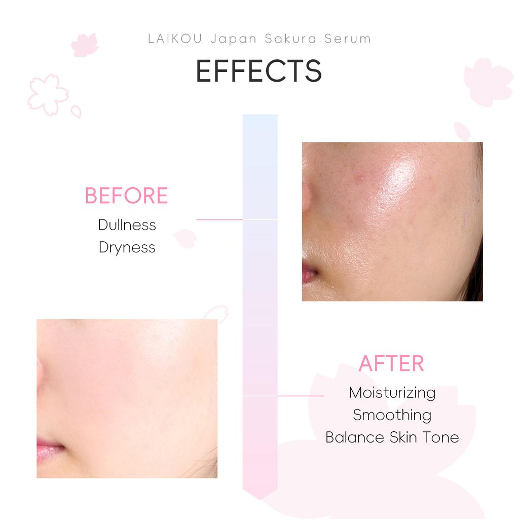 Сыворотка для лица Sakura Whitening от мелких морщин, сужает поры, улучшает пигментацию меланина, тусклость, увлажняющее средство, осветление, уход за кожей