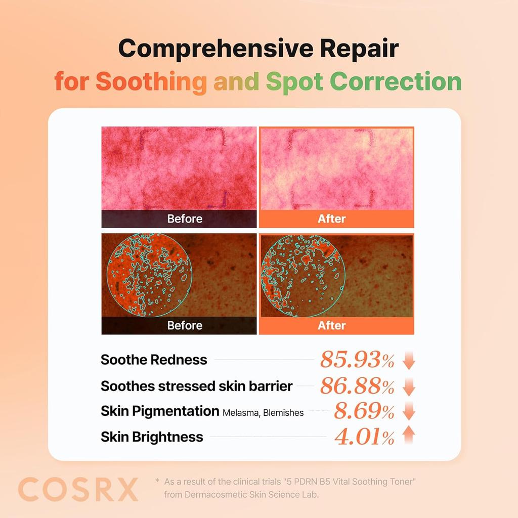COSRX 5 PDRN B5 Успокаивающий тонер 280 мл