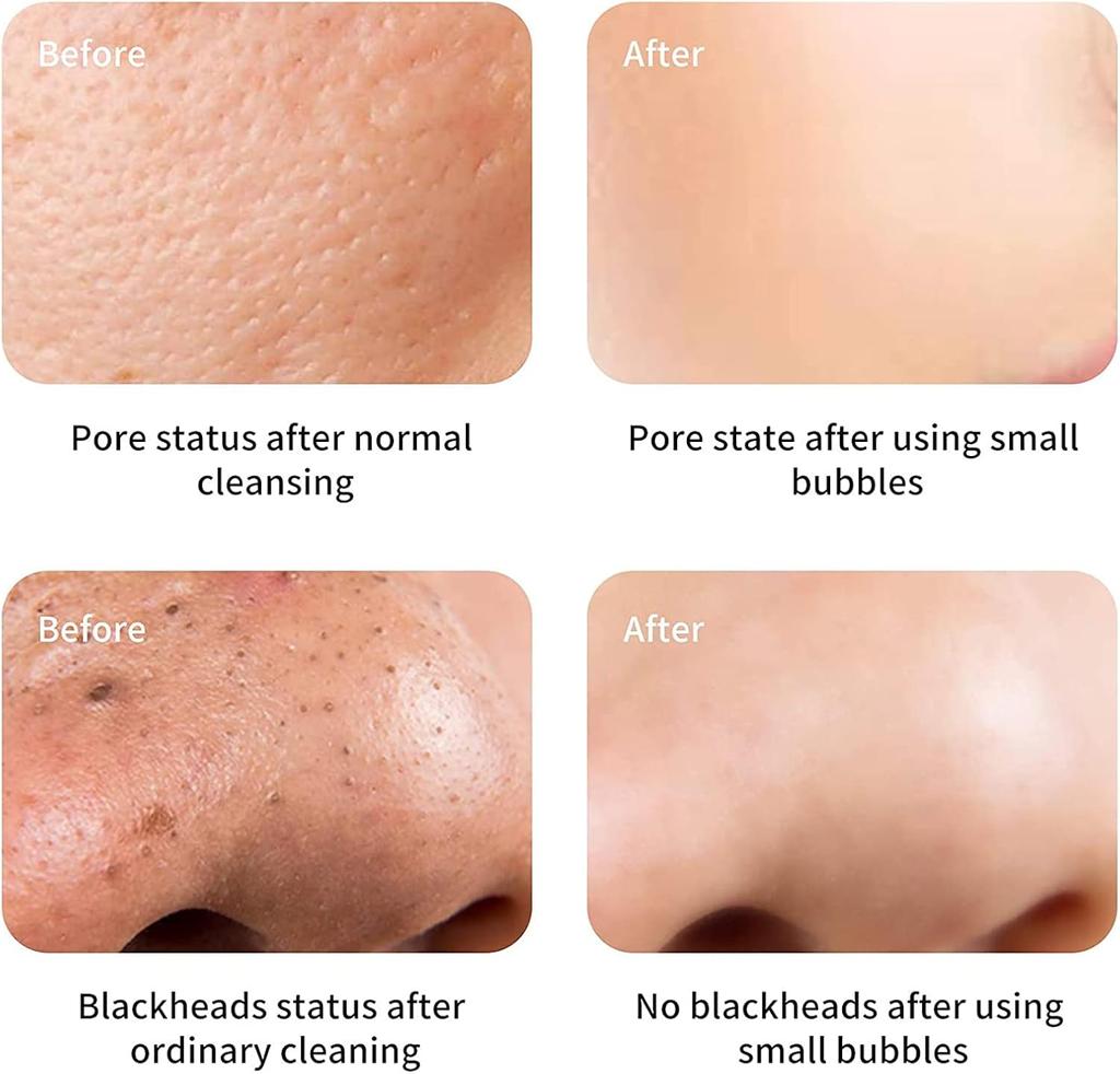 8 In 1 Multifunctional Hydrogen Oxygen Bubble Facial Beauty Machine Face Skin Rejuvenation Moisturizing Anti Wrinkle Anti Aging