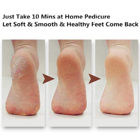 Dead Skin Callus Remover Dry Wet Dual Use Foot File Rasp Pedicure Care Scrubber