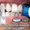 Remover Dental Calculus Whitening Teeth Mouth Odor Removal Bad Breath Preventing Periodontitis