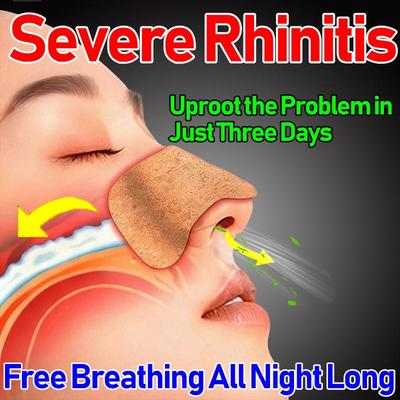 Носовой успокаивающий пластырь и пластырь для акупунктурных точек - Облегчает ринит и синусит, Подходит для детей