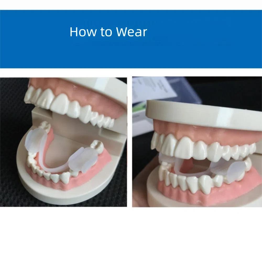 2Pcs Comfortable Anti Snoring Mouth Guard with Storage Box Snoring Mouth Guard Bruxism