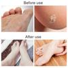 Dead Skin Remover Foot Sharpeners Pedicure Rasp Callus Remover Tool Foot Care Foot File Scraper