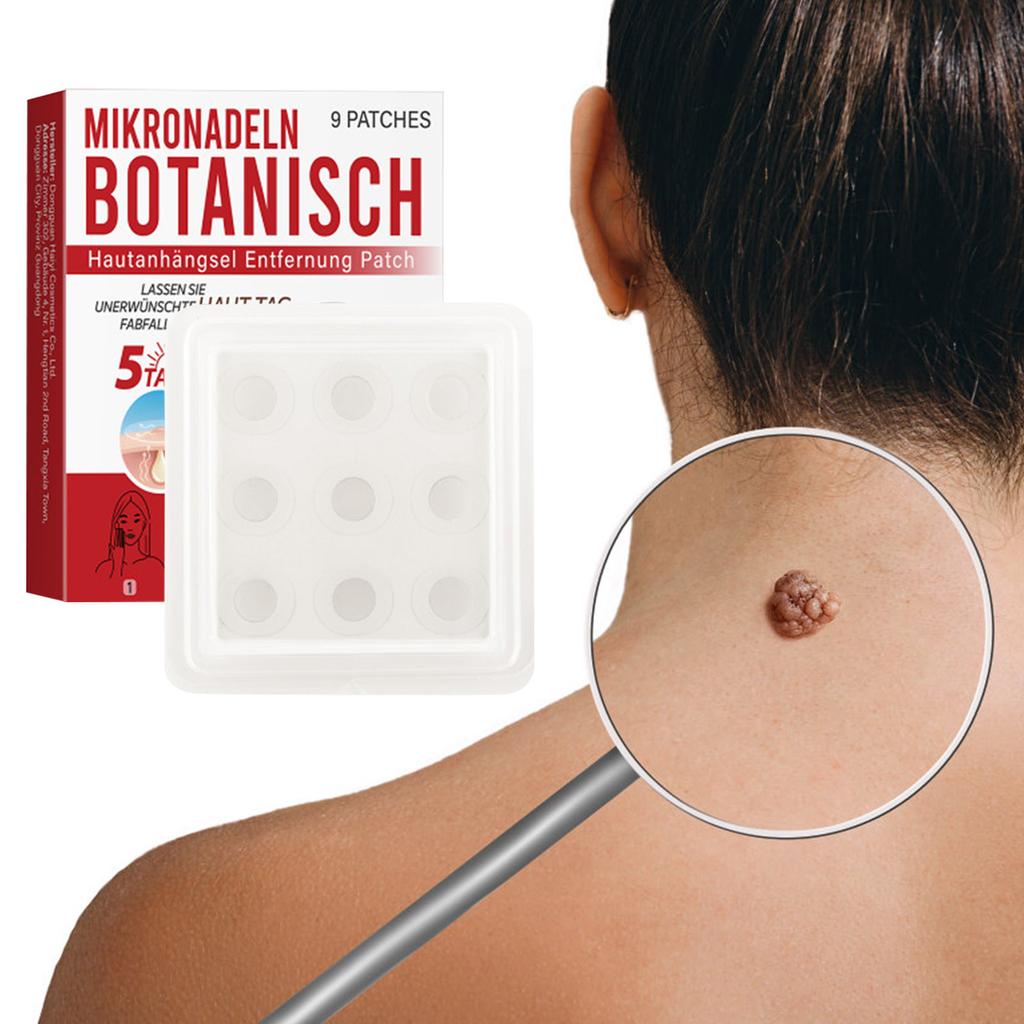 Удаление кожного невуса Микроигольный пластырь для уменьшения плоских невусов Уход за лицом и глазами.