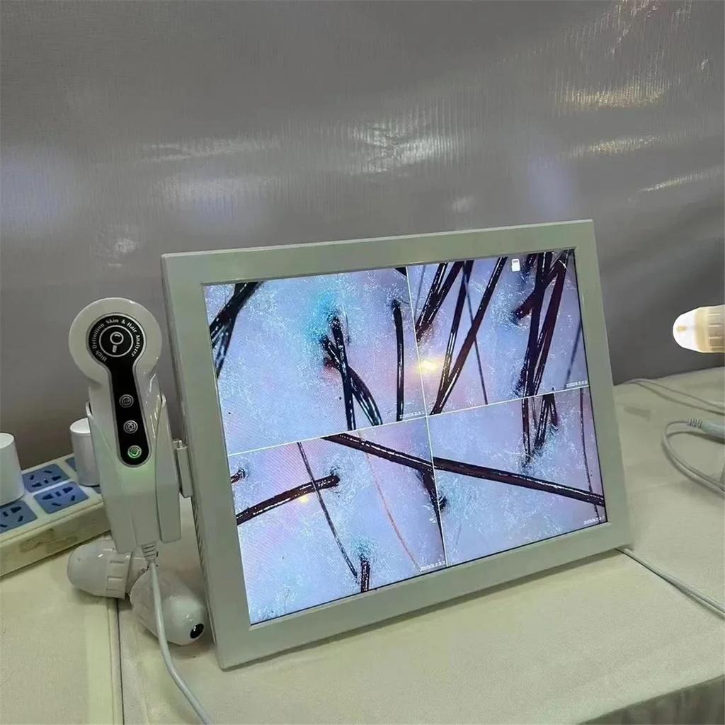 HD Digital Skin Analyzer Professional Hair Scalp Camera Detector Hair Follicle Oil Moisture Test Device 15inch