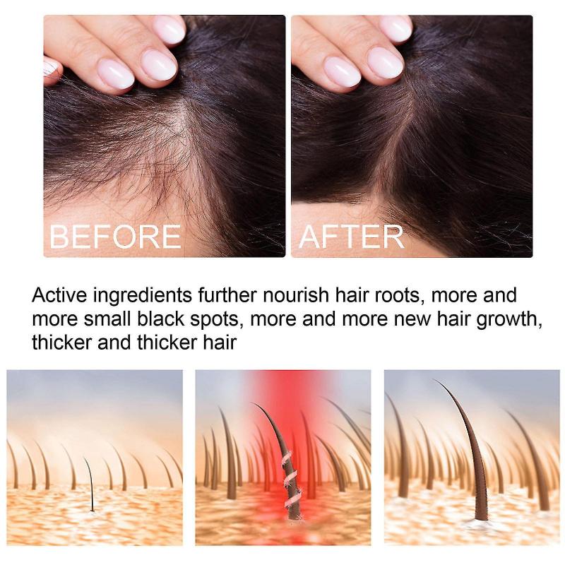 20ml Ginger Spray Regrowth Ginger Spray Fast Hair Growth Fluid Anti Loss Treatment Ginger Essence