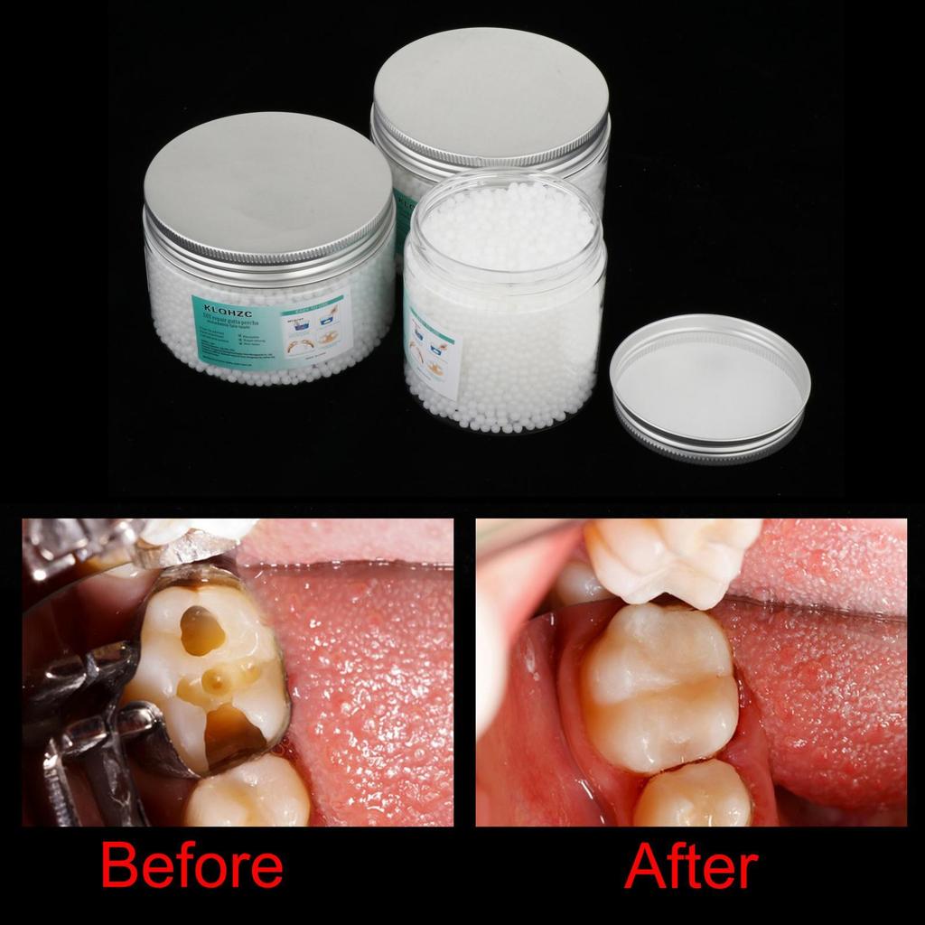 Temporary Tooth Filling Repair Kit Moldable for Fake Teeth Veneer