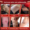 Varicose Veins Relief Cream - Natural Herbal Blend Gentle On Delicate Skin