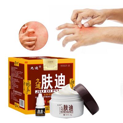 Травяной крем против укусов комаров и зуда кожи, местный крем против зуда