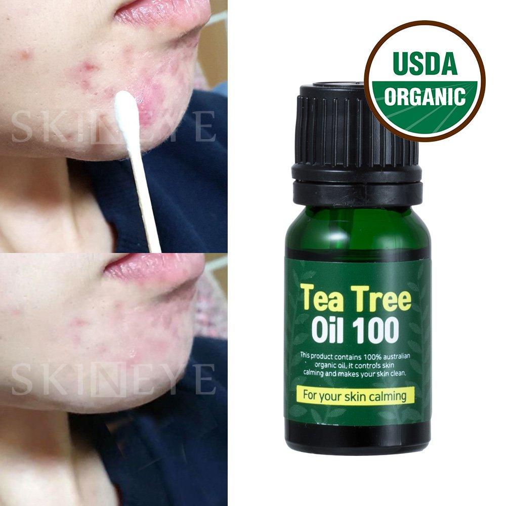 Organic tea tree oil 100 (trouble, mosquito soothing)