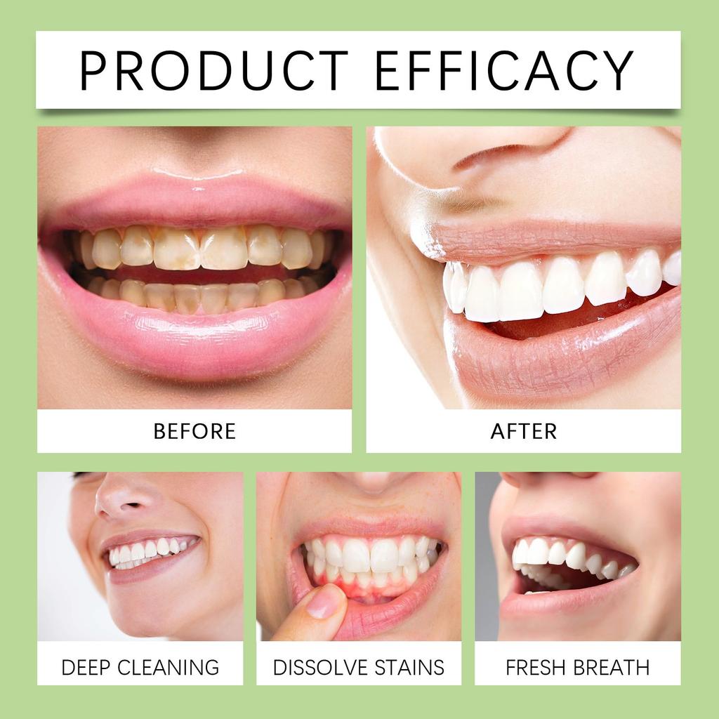 Очищающая зубная паста с алоэ нежно очищает зубы, устраняет запах, пятна, осветляет и украшает зубы