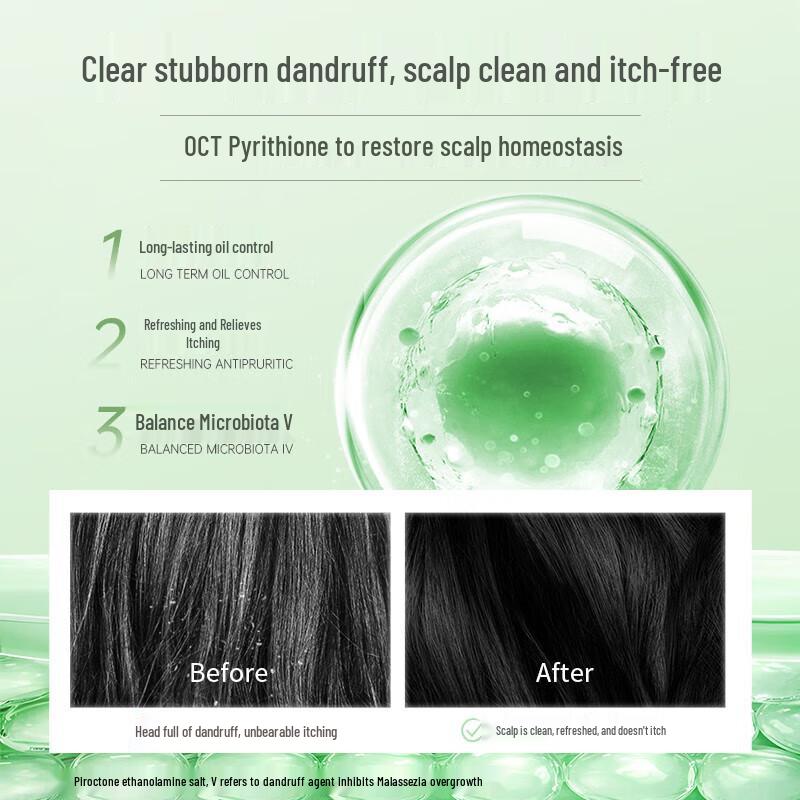 YuJie Forest Wood Scent Anti-Dandruff Shampoo