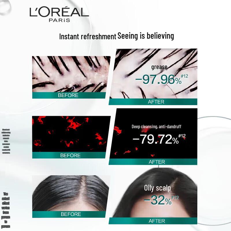 L'Oreal Volumizing & Scalp Purifying Shampoo 440ml