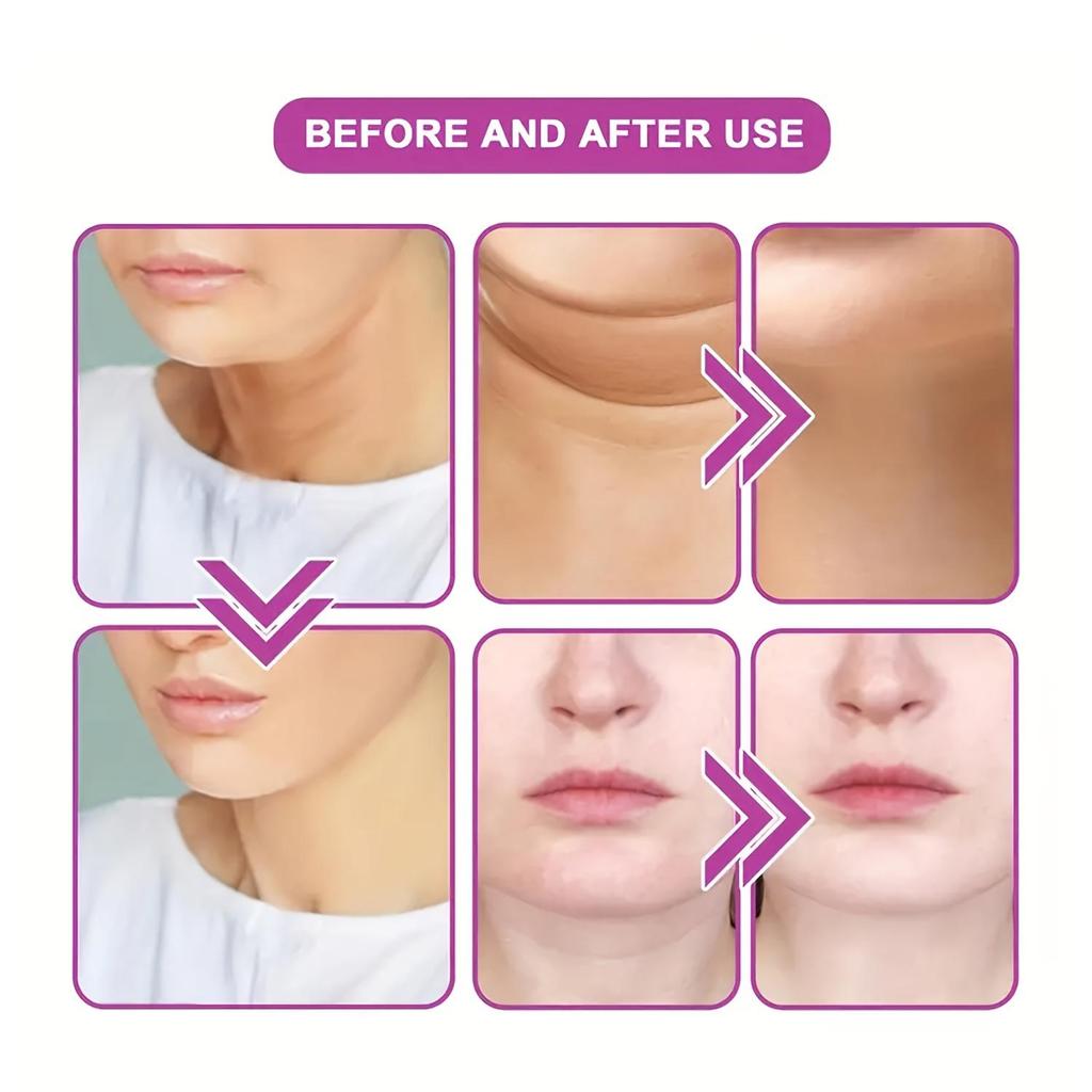 Укрепляющий крем для шеи - увлажняющий крем для лица, гиалуроновая кислота - уменьшение двойного подбородка, укрепляющий увлажняющий крем