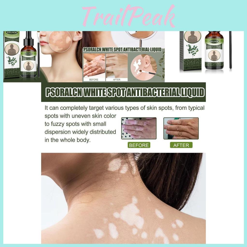 Eelhoe White Spot Repair Serum For Skin Brightening Moisturizing And Nourishing Care