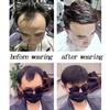 Men's Forehead Frontal Hair Piece M Loop Front Hairline With Tapes for Men Hair Replacement System