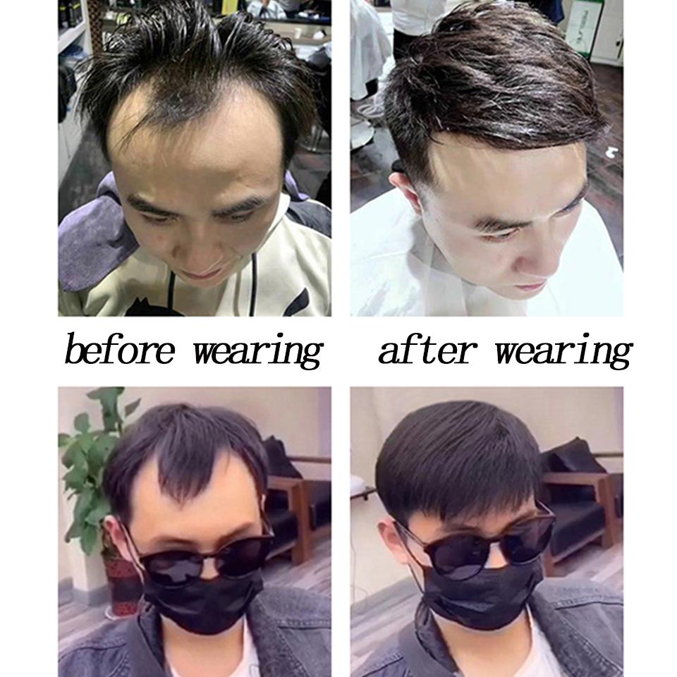 Men's Forehead Frontal Hair Piece M Loop Front Hairline With Tapes for Men Hair Replacement System