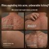 Dr. Rafiq Sulfur Anti-Acne and Anti-Mite Body Wash