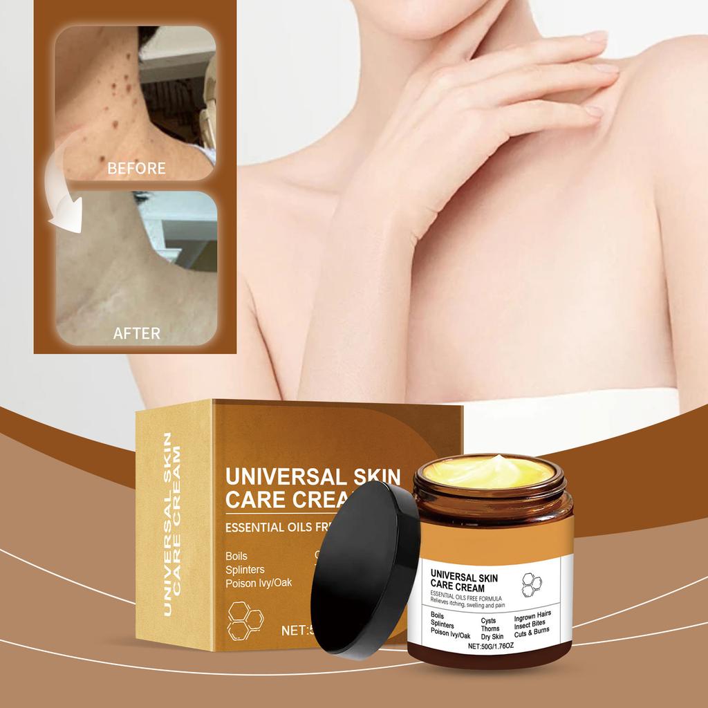 Универсальный крем для ухода за кожей, успокаивающий крем для кожи, устраняет папилломы и родинки; Устраняет сухость, чувствительность, вызванную экземой, 1 шт, 50 г