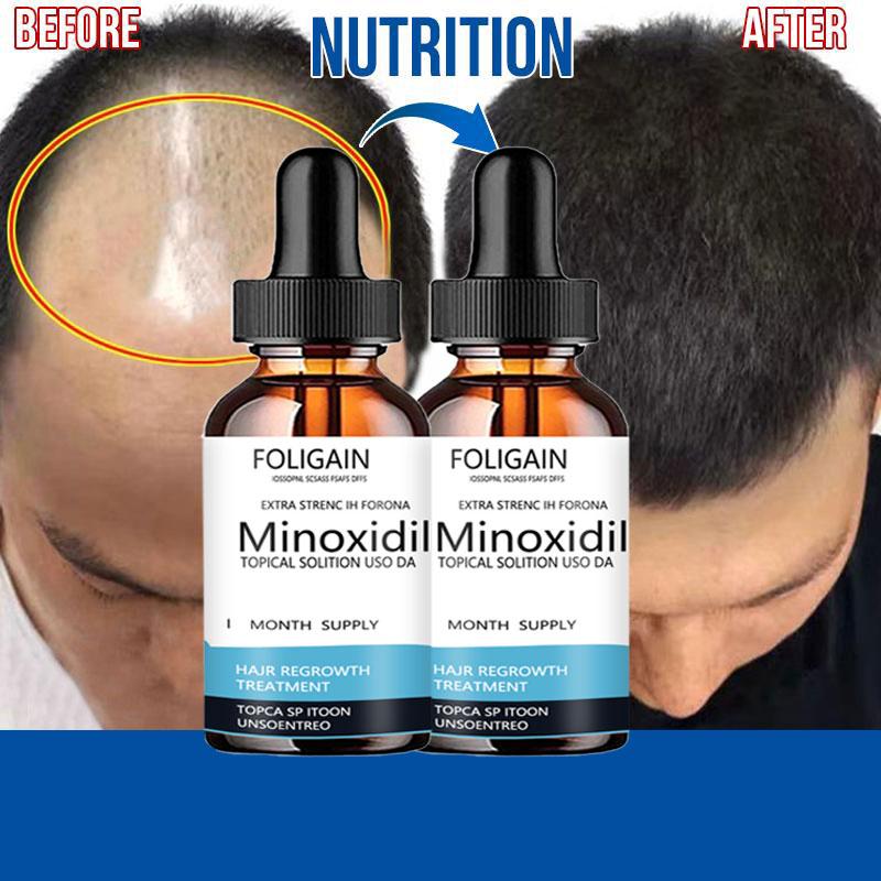 Hair Conditioner Anti Hair Loss Essence Hair Growth More Luxuriant Nourishing Hair Moisturizing Hair Essence