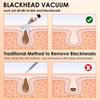 3 Suction Mode Vacuum Pore Cleaner Deep Cleansing Blackhead Suction Device  Blackhead Extraction