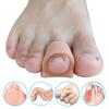 1 Soft Gel Toe Separators Toe Spacers Corrector for Overlapping Foot Care Tool