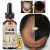 Essential Oils Products Fast Regrowth Serum Beard Growth Oil Hair Loss Care