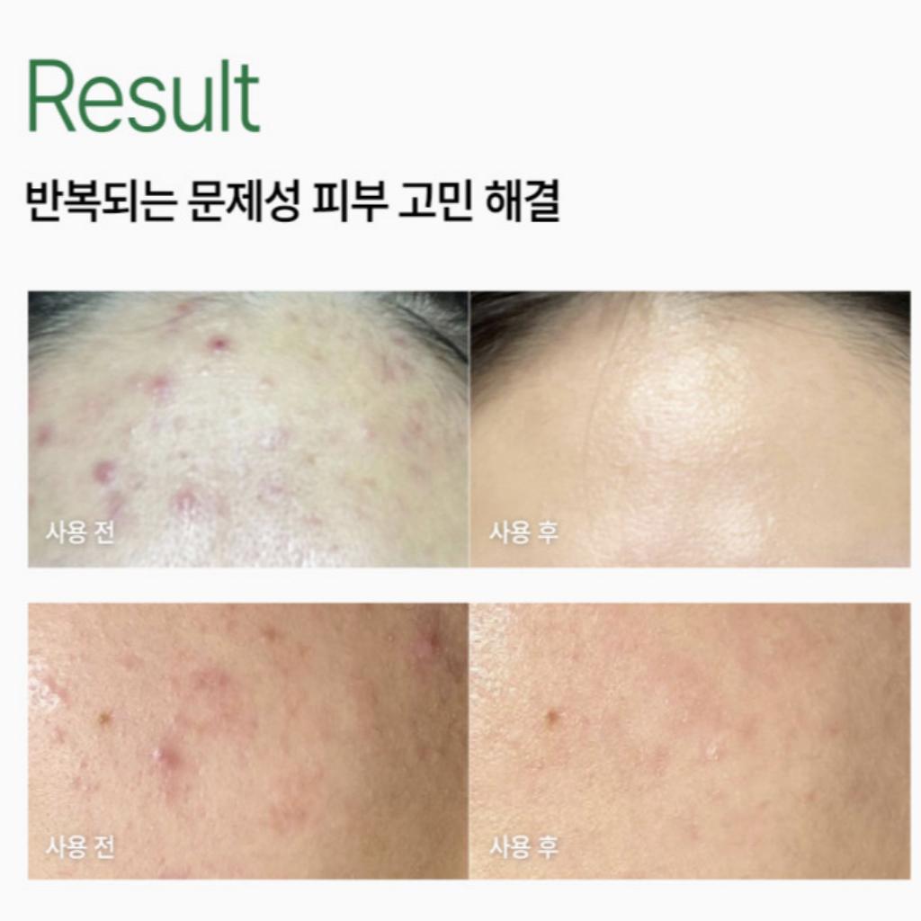 [Vemontes] AXCNE Бустер-крем 25мл