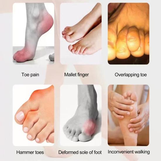 2 пары гелевых пяток, снимающих боль, дискомфорт при ходьбе, регулируемые удобные носки на каблуке, унисекс