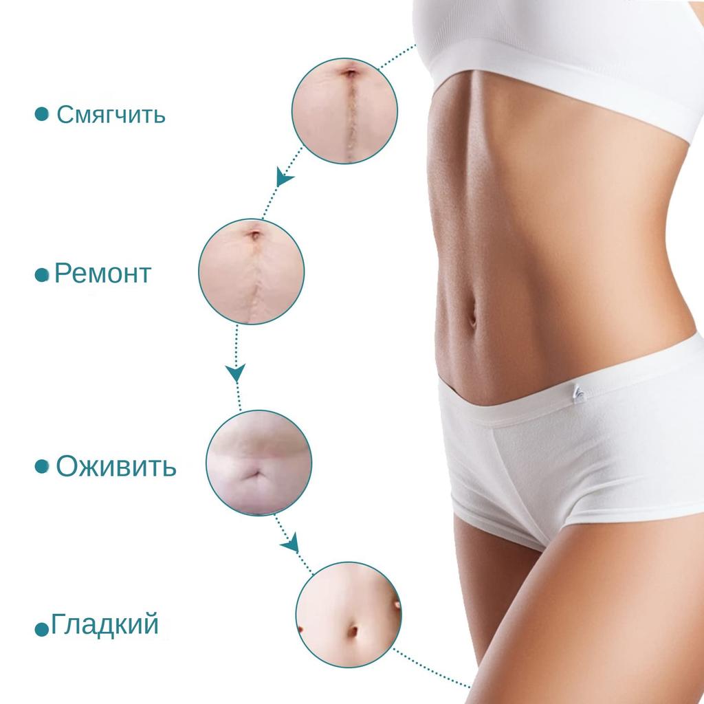 Эффективная хирургическая самоклеящаяся силиконовая гелевая лента для удаления шрамов, терапевтическая заплата для лечения прыщей, травм, ожогов