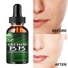 Facial Acne Removing Essence Restores Acne Removing Damaged Skin Moisturizing Essential Oil Nourishes Facial Skin Care Fluid