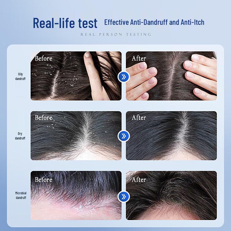 Watsons Oil Control Anti-Dandruff Shampoo 500ml