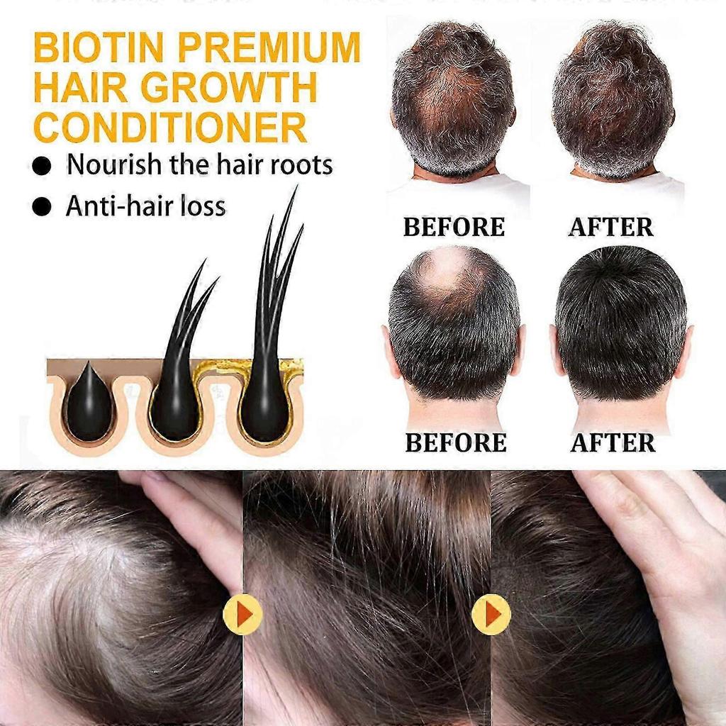 Biotin Conditioner for Hair Growth  Moisture  Nourishing, Thickening, and Shine