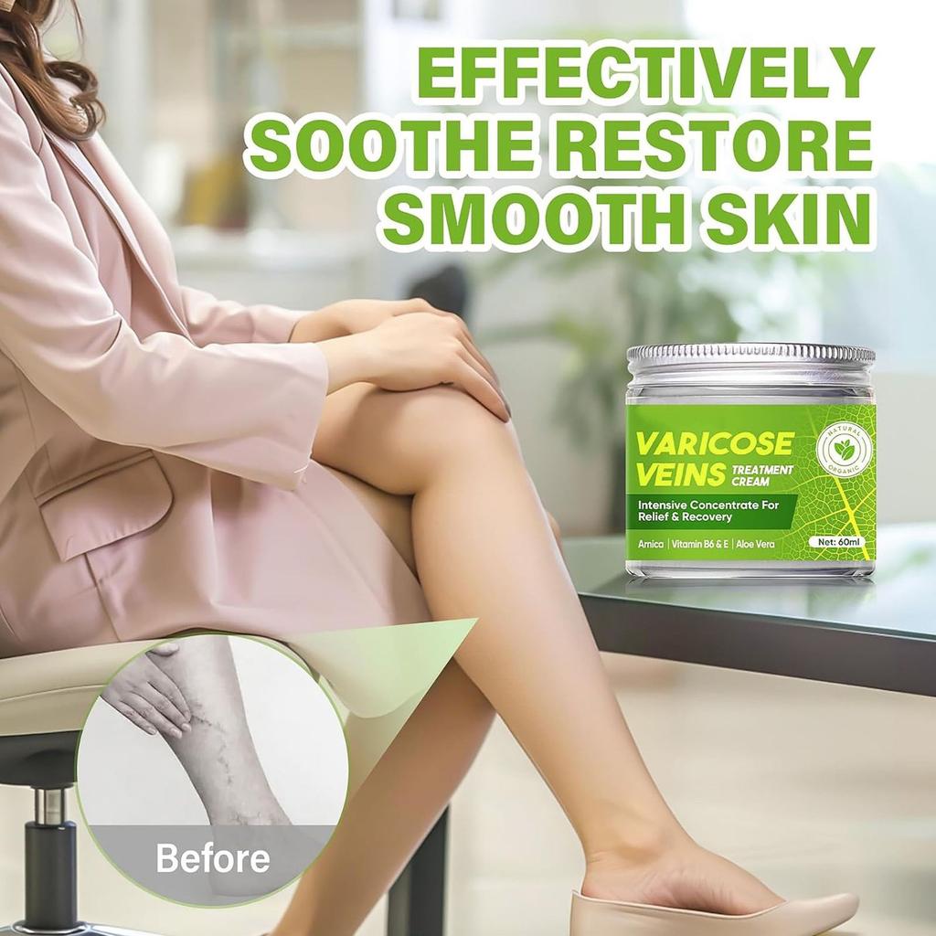 Крем для успокоения вен, крем для восстановления ног, улучшает кровообращение и питает гладкую кожу