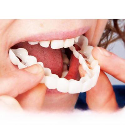 Съемные силиконовые брекеты Snap-On Smile для отбеливания верхних и нижних зубов