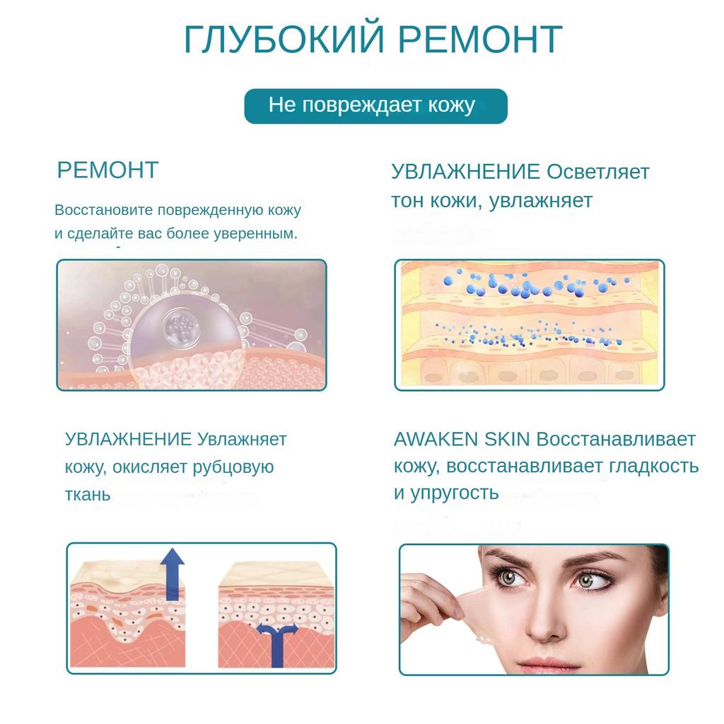 Эффективная хирургическая самоклеящаяся силиконовая гелевая лента для удаления шрамов, терапевтическая заплата для лечения прыщей, травм, ожогов