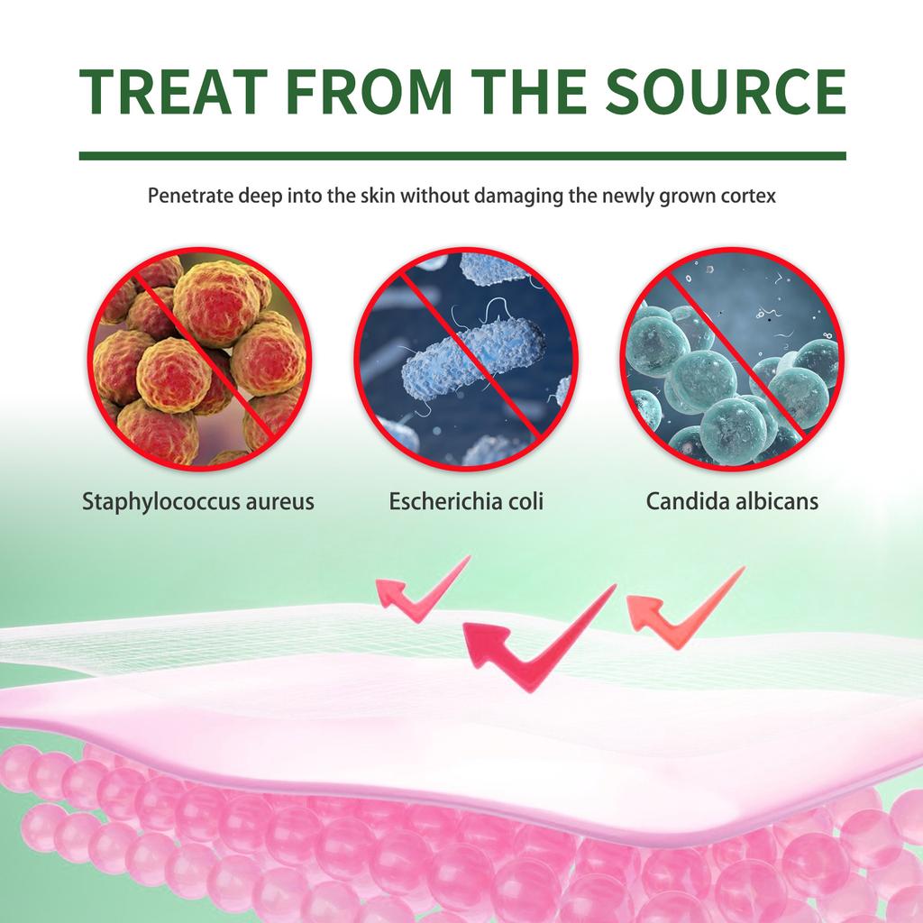 Nail Repair Foot Mask Nail Repair Gray Nails Shiny Nails Dry and Cracked Feet Removing Dead Skin