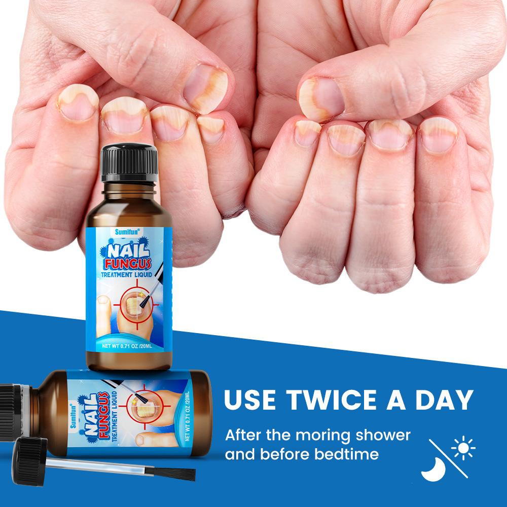 Sumifun Раствор для восстановления ногтей для лечения ногтей