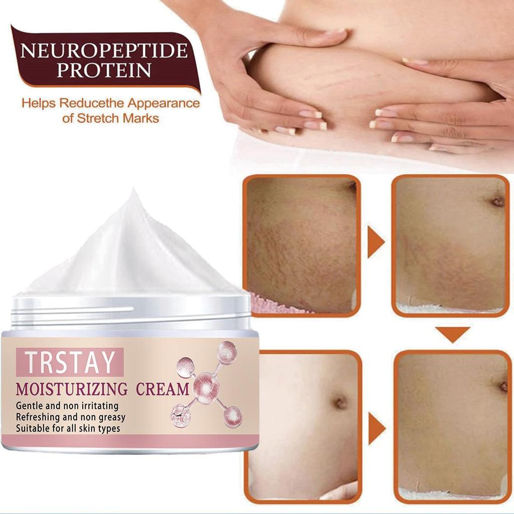 Сыворотка для удаления шрамов от прыщей, масло, эфирные масла, эссенция, гель, лечение растяжек, прыщи, пятна от прыщей, хирургические шрамы, ожоги