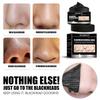 The latest 2025 blackhead removal mask, a peel-off activated charcoal cleansing mask, effectively removes blackheads.